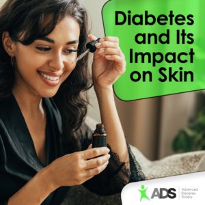 taking-care-of-skin-with-diabetes
